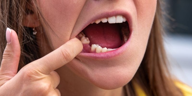 Mơ thấy rụng răng có ý nghĩa tiềm ẩn thế nào? Mơ thấy rụng răng có ý nghĩa tiềm ẩn thế nào?
