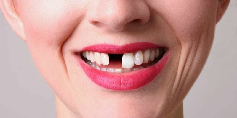 Con Số May Mắn Liên Quan Đến Giấc Mơ Rụng Răng Con Số May Mắn Liên Quan Đến Giấc Mơ Rụng Răng
