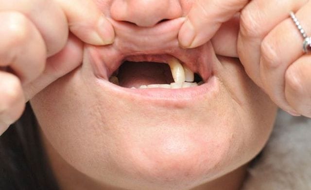 Mơ rụng răng cửa tương ứng với con số may mắn nào?