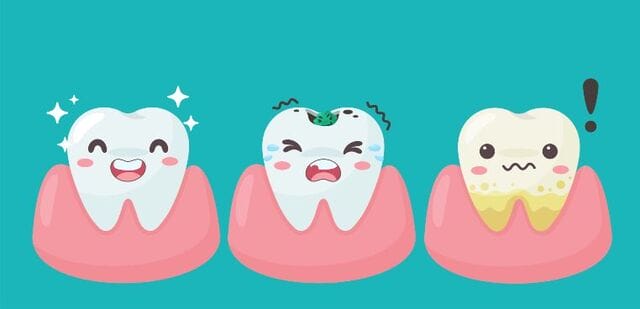 Mơ thấy chiếc răng sâu bị rụng