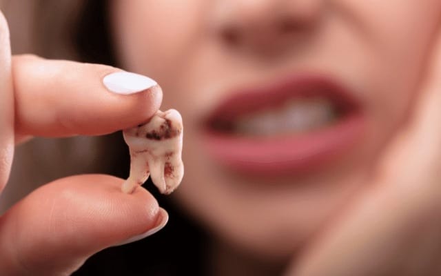 Mơ thấy đang đi nhổ răng sâu
