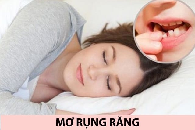 Mơ thấy rụng răng hàm dưới đánh số mấy?