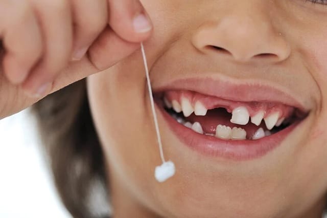 Hai chiếc răng rụng cho thấy áp lực nhân đôi