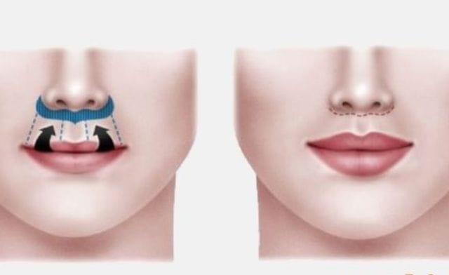Theo góc độ tâm linh môi dưới bị lật là điềm gì?