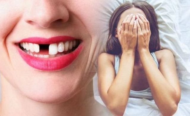 Tùy thuộc vào bối cảnh mà ý nghĩa mơ thấy rụng răng cửa sẽ khác nhau