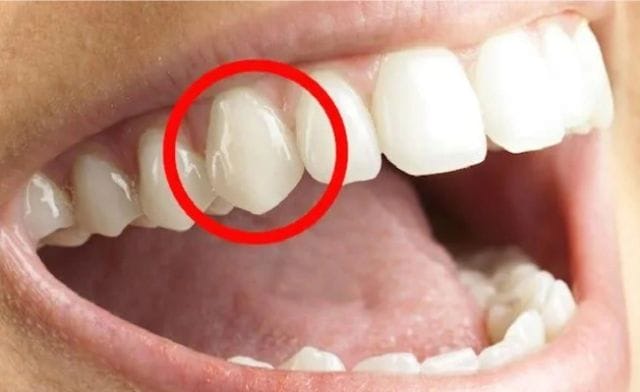 Ý nghĩa mơ thấy mọc răng theo từng bối cảnh khác nhau thế nào