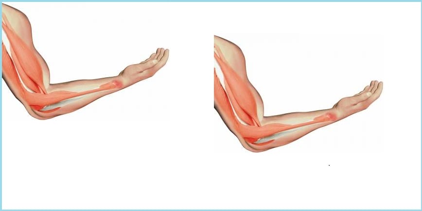 Thấy giật cơ bắp tay phải vào ban đêm lúc 1 đến 3 giờ sáng