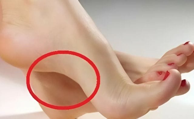 Ngứa lòng bàn chân dưới góc nhìn tâm linh và khoa học là gì?